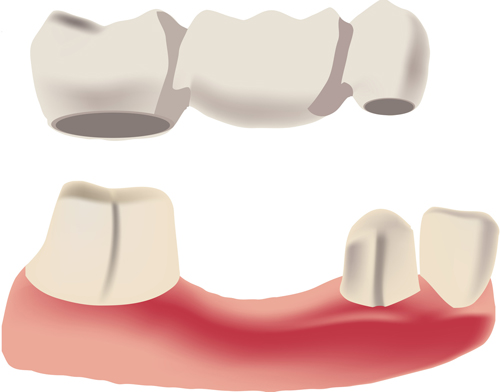 denture